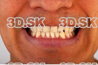 Teeth reference of Mack 0001